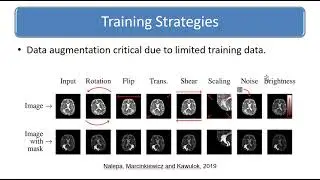 U Net Convolutional networks for biomedical image segmentation