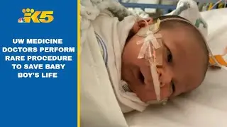 UW Medicine performs life-saving surgery on baby boy with rare birth defect