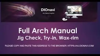 DIO Full Arch Jig -check and Try-in Order