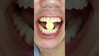 The Most Satisfying Chocolate and Candy ASMR Compilation 🍫🍬 #DoctorTristanPeh #Chocolate #Candy