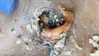Extremely Long Toenails, Abnormal Growth Of Black Mud | GFHJN 55