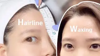 원숭이 이마, 생애 첫 M자 이마 탈출기 헤어라인 왁싱 했어요. 예쁜 이마로 자신감 뿜뿜 Hairline Waxing in korea 뷰티일상 브이로그