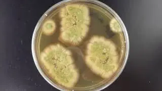 Beautiful Mold Cultures