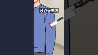 칼에 '팔' 찔렸을 때 살아남는 방법(반대로 하면 끝입니다ㄷㄷ)