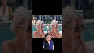 Barbie Botox - Skin Tightening, Botox and Lip Fillers by Skinsation LA