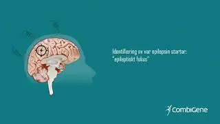 Biostock Live - 2018-08-29 - Presentation CombiGene