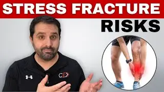 The 5 Most Common Risk Factors for Stress Fractures in Runners