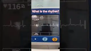 What is the rhythm? EP.4 #shorts #ekg  #ecg #frontlineekg