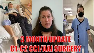 3 Month update: C1-C2 Fusion Surgery #AAI #CCI #WeNeedToTalkAboutCCI