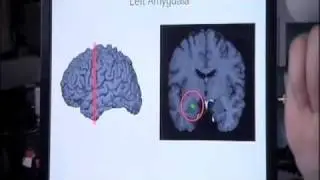 FixingFaces: Michael Mosely enters the MRI scanner to see how distorted faces affects the brain