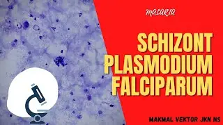 SCHIZONT PLASMODIUM FALCIPARUM