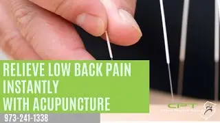 Relieve Low Back Pain Instantly with Acupuncture