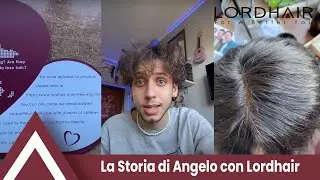 Risolve la tua perdita di capelli con un sistema per capelli! | Lordhair