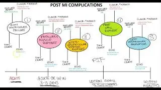 Post MI Complications