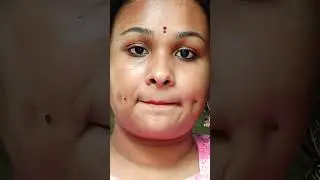 My Sweet Dimple | Dimple Queen