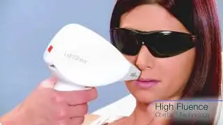Lumenis LightSheer Desire Laser Hair Removal