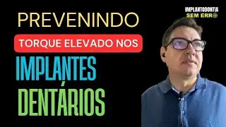 Sabendo disso voc&ecirc; previne o torque elevado com implantes dent&aacute;rios