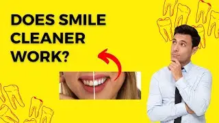 CLEANER SMILE  - 🤔REVIEW🤔- Cleaner Smile Teeth Whitening Kit | Does Smile Cleaner work?
