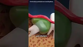 Wisdom teeth extraction #doctor #doggielife #science