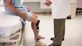Amputation Leg CPT code - simplify medical coding