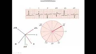 Axis Calculation by equiphasic method