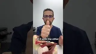 **