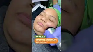 TREATMENT RF FACE DI SKIN POINT