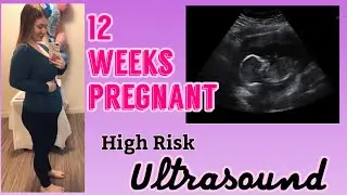 First High Risk Doctor Appointment - 12 weeks pregnant