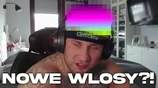 ZROBIŁEM PRZESZCZEP WŁOSÓW!