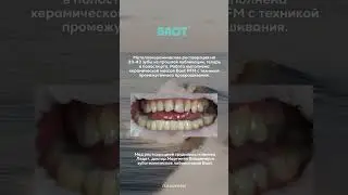 Для заказа керамической массы BAOT:💻 Интернет-магазин russalmed.ru✅ Whatsapp +7-995-119-26-28