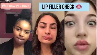 ayo, lip filler check 👄 &bull; tiktok compilation