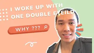 I Woke Up With One Double Eyelid | Eyelid Crease Questions on Quora
