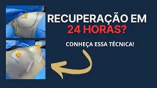 QUAIS AS PRINCIPAIS VANTAGENS DA R24R? | Dr. Cristian e Dra. Raquel