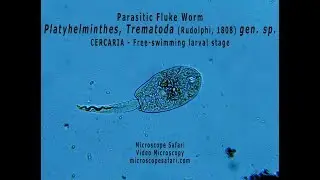 Parasitic fluke worm - Trematode cercaria (larva)