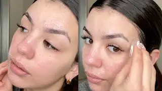 RUBBING AN ICE CUBE ON MY FACE FOR CLEAR SKIN #SHORTS #YouTubePartner