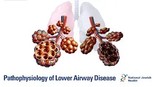 Pathophysiology of Lower Airway Disease