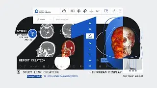 New features of Inobitec Web DICOM Viewer 2.10