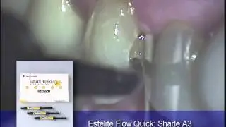 4. Tutorial film about products Tokuyama Dental