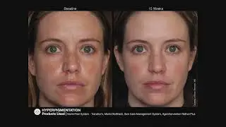 Jan Marini Skin Research - John Connors, CEO & President - AIS 2022 Spotlight on Skin Health