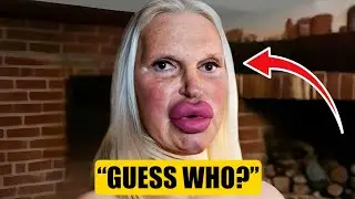 He Was a Famous Actor Before His Plastic Surgery, Guess Who | Then and Now 2025