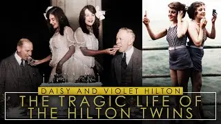 The Tragic Story Of The Hilton Twins | Daisy And Violet Hilton | Siamese Conjoined Twins
