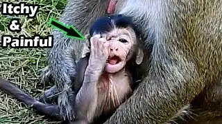 Eye Problem!Young Baby Monkey Mia Has Itchy And Pain On Her Eye |What Fill In Do She Hurt Like That