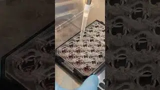 Handling the &micro;-Plate 24 Well for Membrane Inserts #CellCulture #Microscopy #Transwell  #imaging