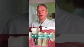 Diş &Ccedil;ekimi Sonrası Hemen İmplant Yapılır mı?