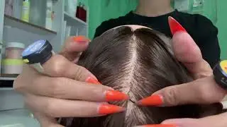Extreme Scalp Cleaning ASMR | Dandruff Removal with Tweezers, Comb & Long Nails IMG 6720