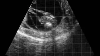 Bovine fetus 90 day calf head measurement