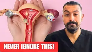 STOP Believing These Prolapse Myths!