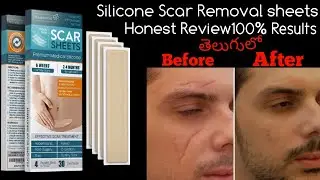 Silicone Scar Removal sheets Review Telugu