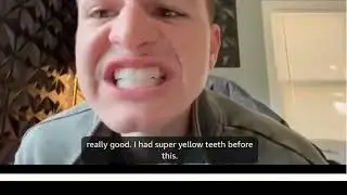 How to use Crest 3D Whitestrips Vivid Plus: 6 Easy, Effective Methods