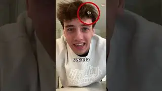 C&oacute;mo quitarse el CHICLE del cabello 👏
